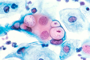 Мазок с Chlamydia trachomatis под микроскопом.