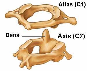 Два верхних шейных позвонка - Атлант (Atlas) и Аксис (Axis).